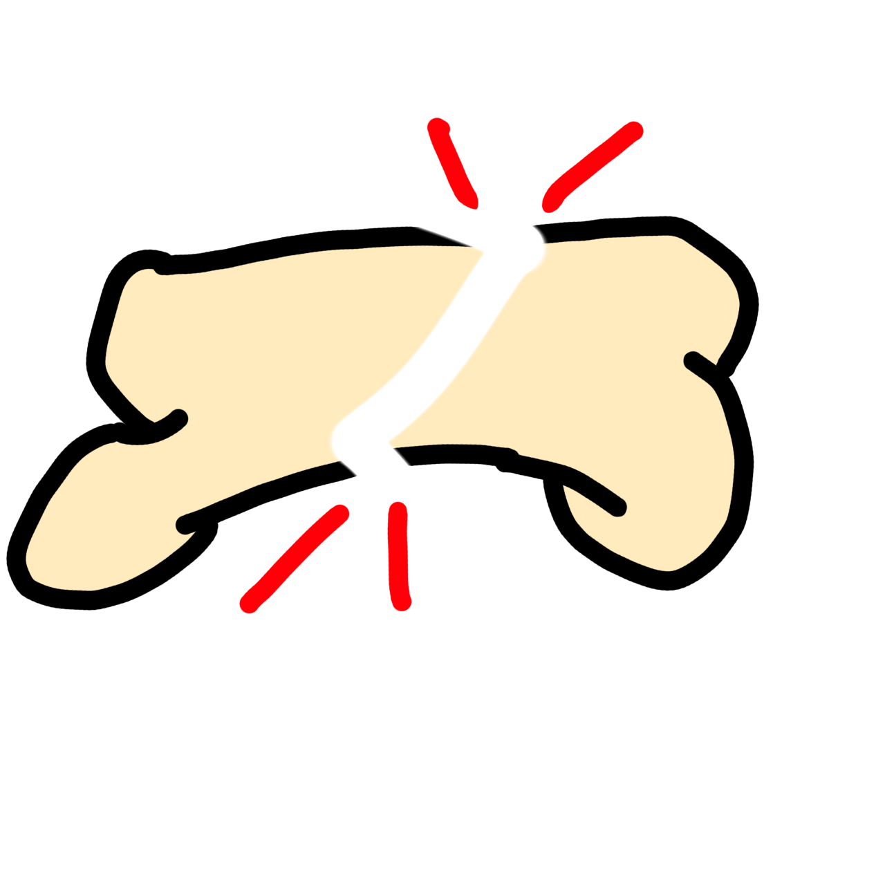  an off white bone with a jagged gap between the two halves of it. There are red emphasis or pain lines around the break.